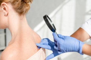 cropped view of dermatologist examining skin of patient with magnifying glass in clinic