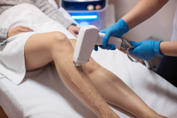 Woman removing her hair with laser epilator